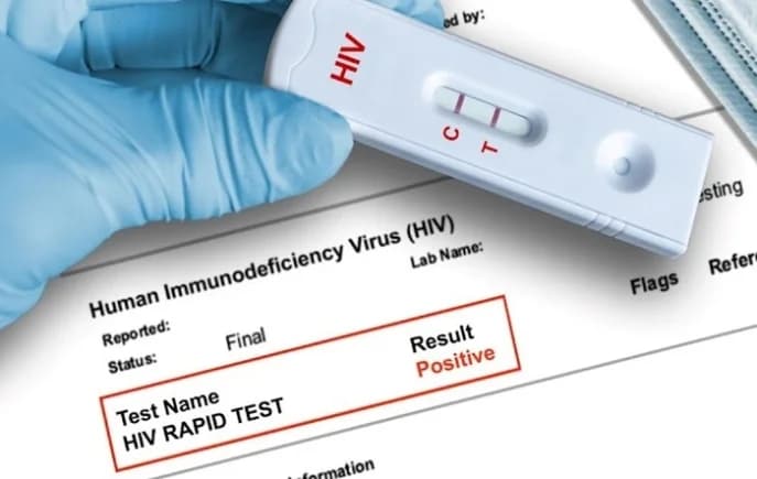 FDA Issues Urgent Alert Over Counterfeit HIV Test Kits Amid Broader Health Safety Concerns