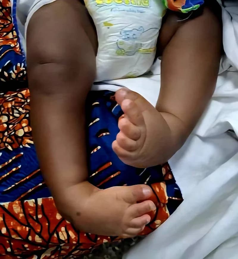 Ghana Intensifies Health Advocacy as Regional Disease Outbreaks and Pediatric Health Challenges Rise