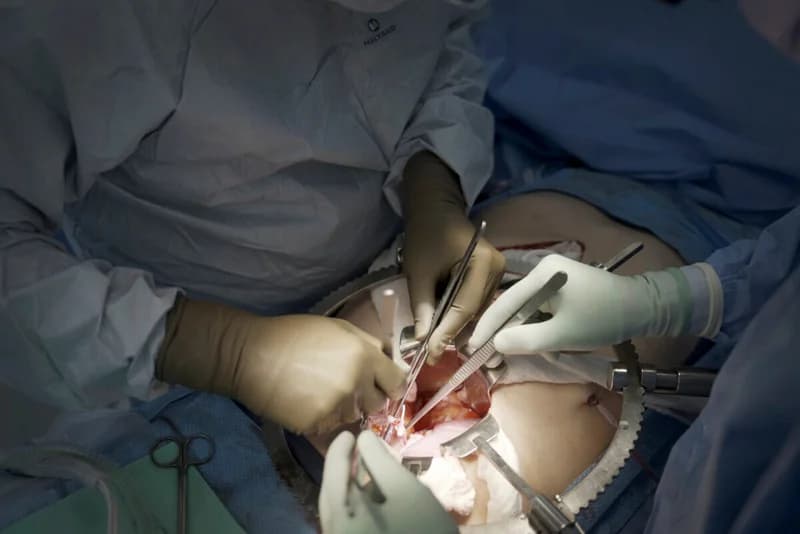 Nexus Global Services and Korle Bu Experts Tackle Surging Kidney Disease Crisis Affecting 20% of Ghanaians