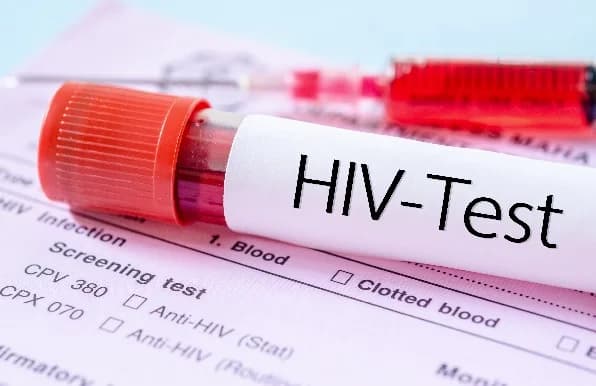 1,300 applicants tested HIV positive in security agency recruitment – Minister