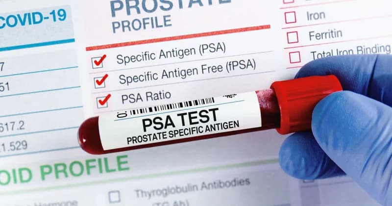 UK Prostate Cancer Diagnoses Reach Record High with One Man Diagnosed Every Eight Minutes
