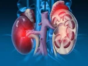 Medical experts warn against six habits linked to kidney damage
